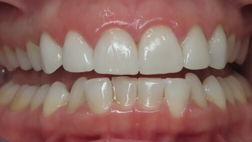 smile gallery image