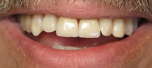 smile gallery image