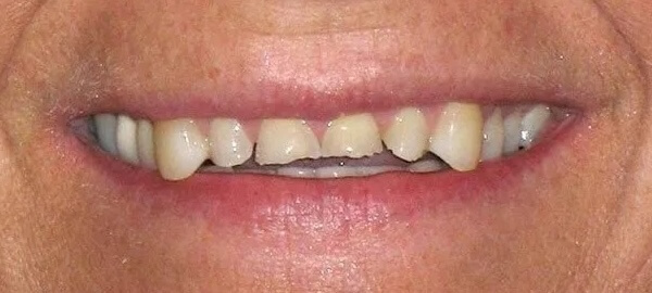 smile gallery image