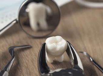 Restorative Dentistry: Composite (White) Fillings VS Amalgam (Silver) Fillings