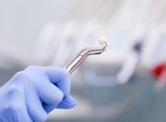 Tooth Extraction Healing Time